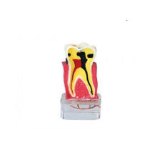 TM-C18 Teaching Model of 4times Periodontal with Nerve